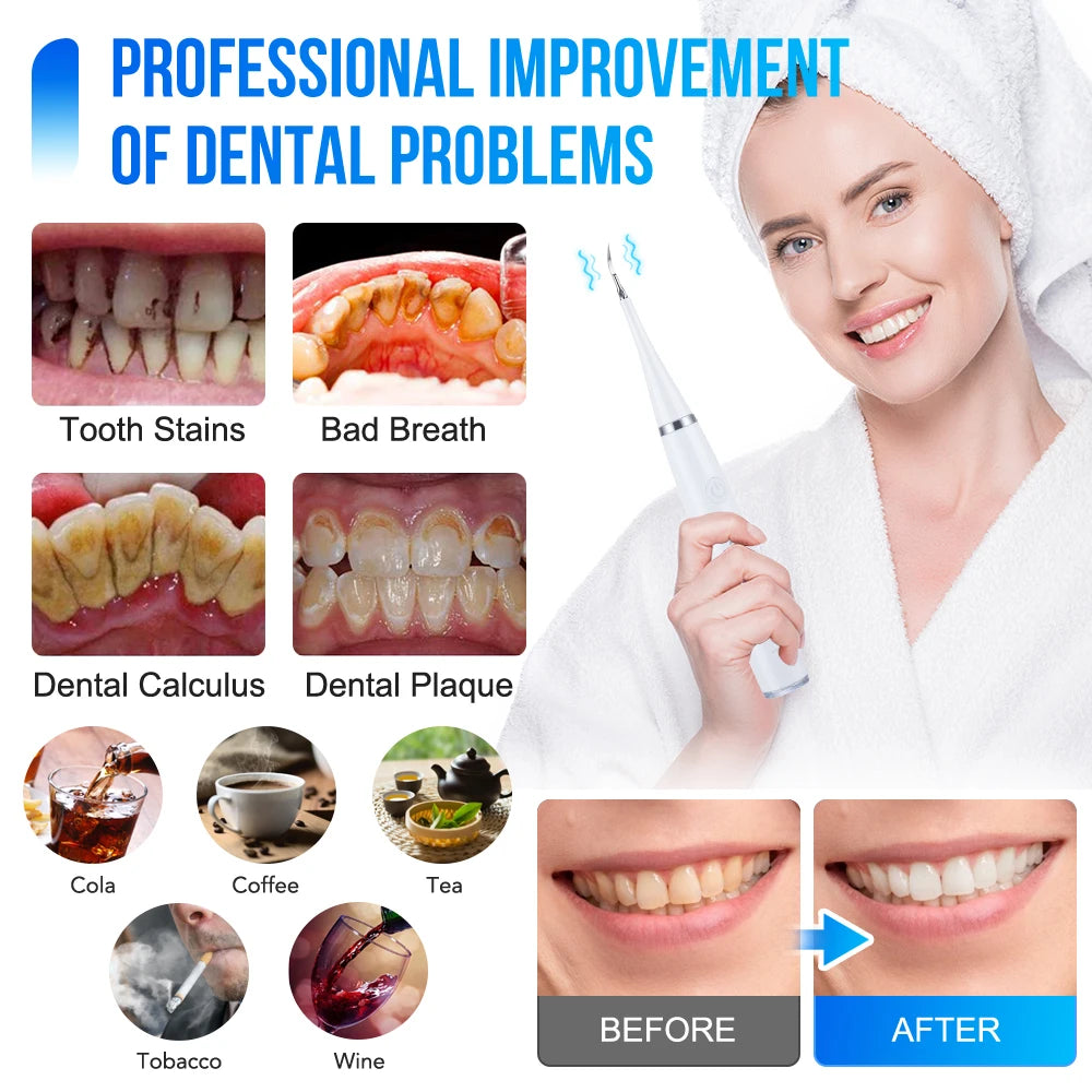 6 in 1 Ultrasonic Dental Cleaner for Effective Plaque Removal - Smarsty