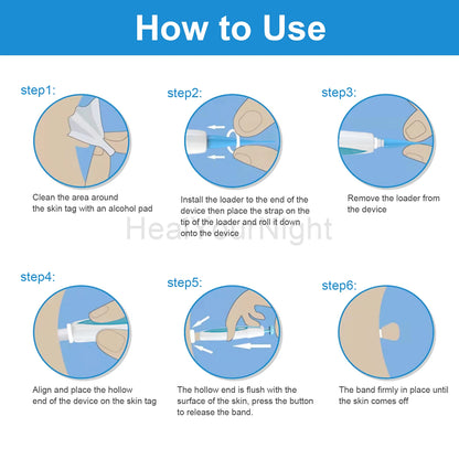 3 In 1 Painless Skin Tag Removal Kit - Smarsty