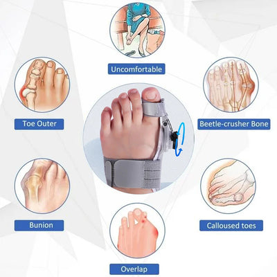 Bunion Corrector Adjustable Hallux Valgus Toe Separator - Smarsty