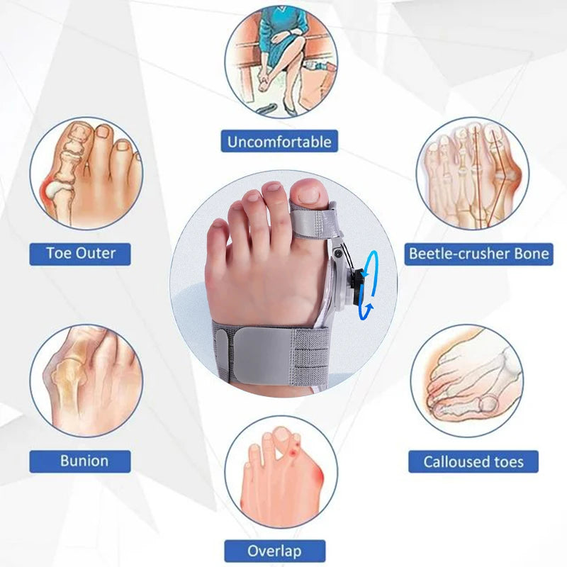 Bunion Corrector Adjustable Hallux Valgus Toe Separator - Smarsty