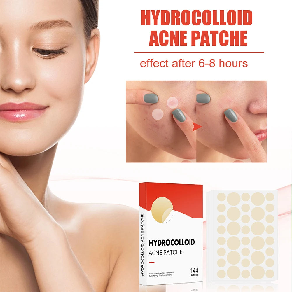 144 Piece Acne Pimple Patch Set for Clear Skin - Smarsty