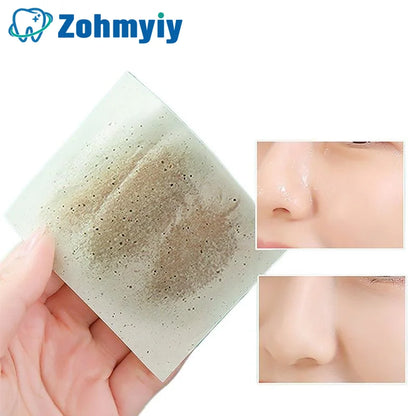 300Pcs Oil Control Blotting Papers for Clean Skin - Smarsty