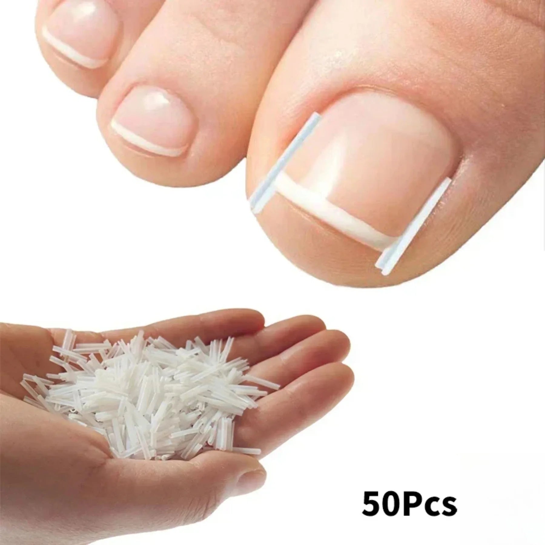 Ingrown Toenail Correction Tool Set for Effective Treatment - Smarsty