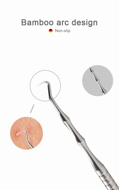 German Blackhead Removal Needle Tool for Clear Skin - Smarsty