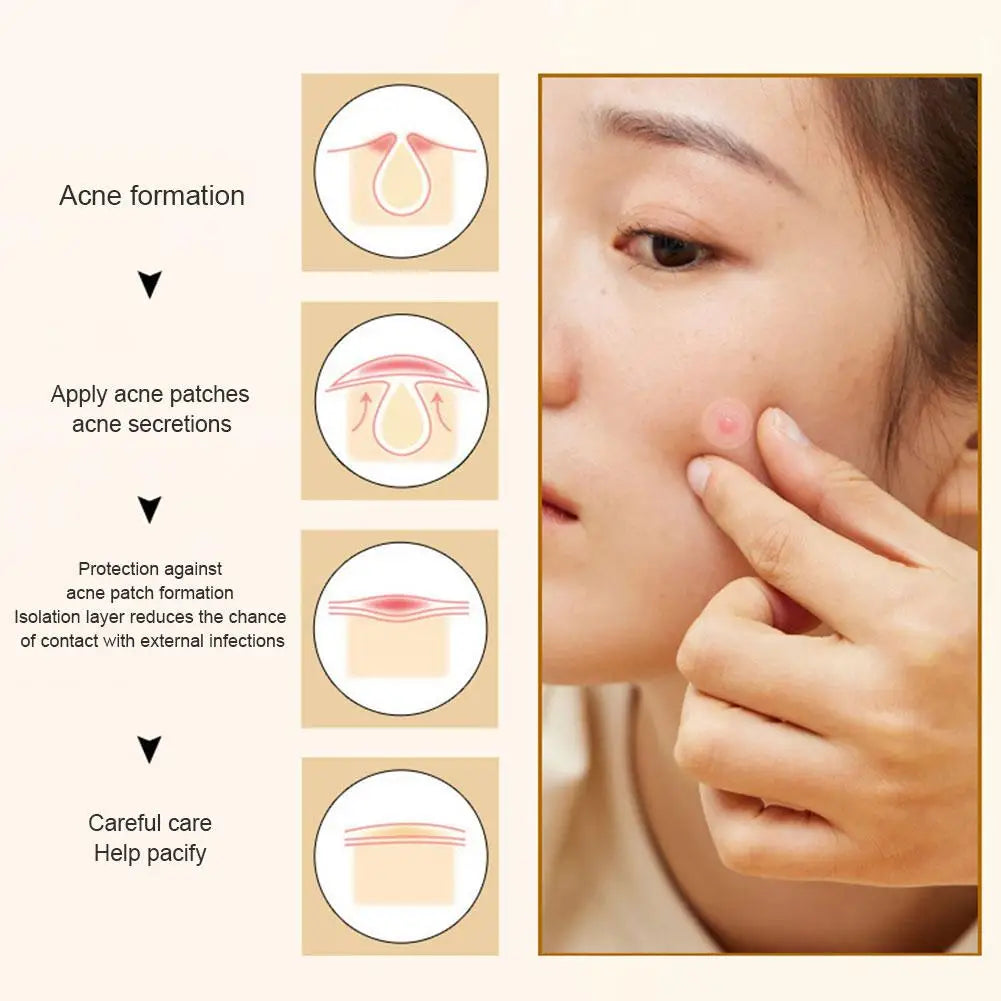 Colorful Star Heart Shaped Acne Pimple Patches - Smarsty