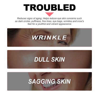 Retinol Eye Cream for Dark Circles and Wrinkles - Smarsty