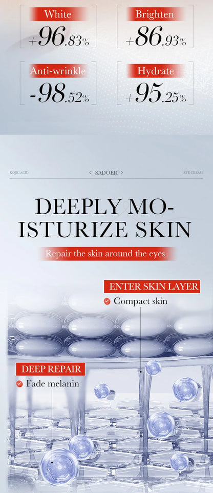 Kojic Acid Retinol Eye Cream for Dark Circles - Smarsty