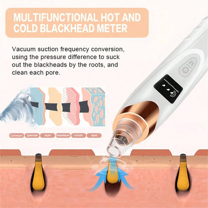 Electric Facial Skin Care Pore Vacuum Blackhead Remover - Smarsty