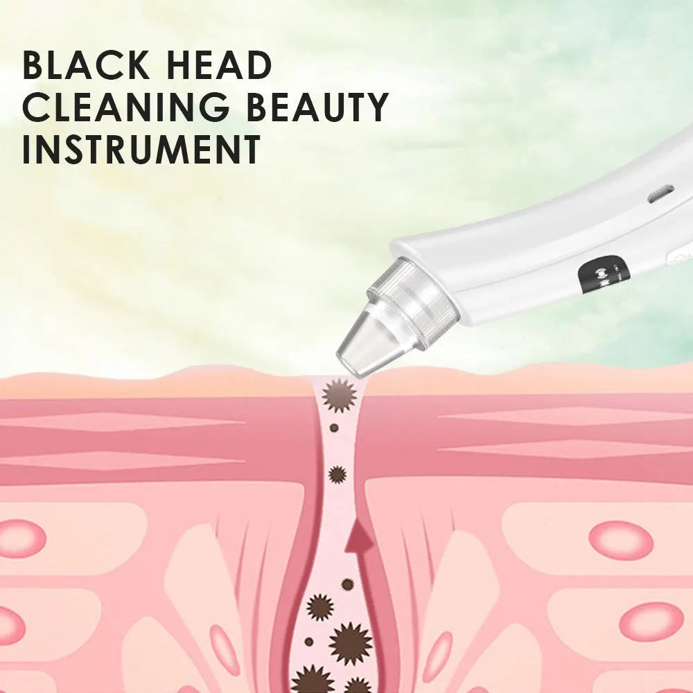 Face Cleansing Beauty Machine with Suction Modes - Smarsty