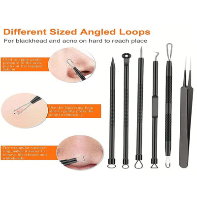 Stainless Steel Acne Removal Tool Set for Clear Skin - Smarsty