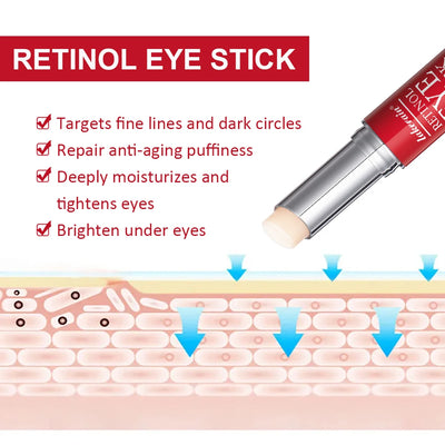 Retinol Eye Cream Stick for Dark Circles and Firming - Smarsty