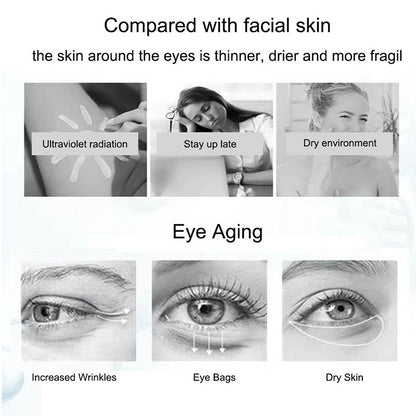 Nicotinamide Eye Cream for Dark Circles and Puffiness - Smarsty