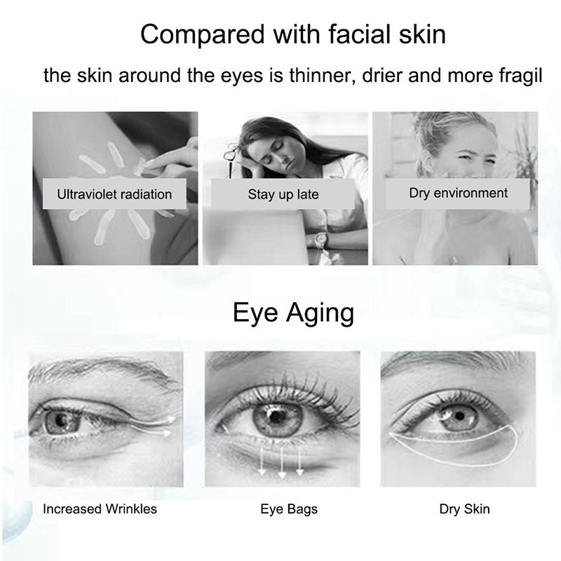 Nicotinamide Eye Cream for Dark Circles and Puffiness - Smarsty