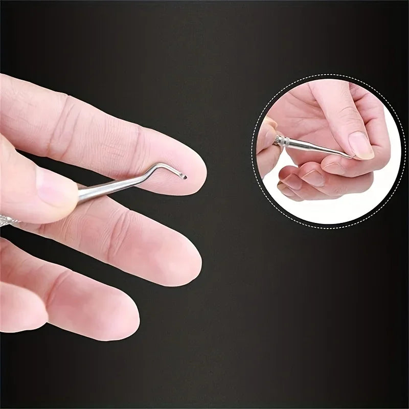 Professional Ingrown Toenail Correction Tool for Effective Pedicure - Smarsty