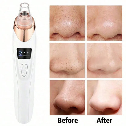 Electric Facial Skin Care Pore Vacuum Blackhead Remover - Smarsty