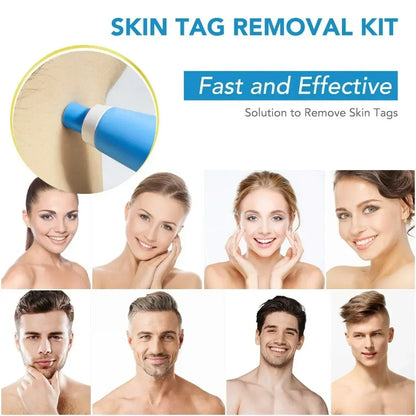 Painless Skin Tag and Wart Removal Kit - Smarsty