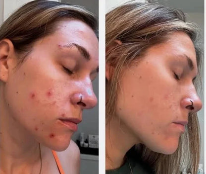 Beef Tallow Face Cream for Lasting Moisturization - Smarsty