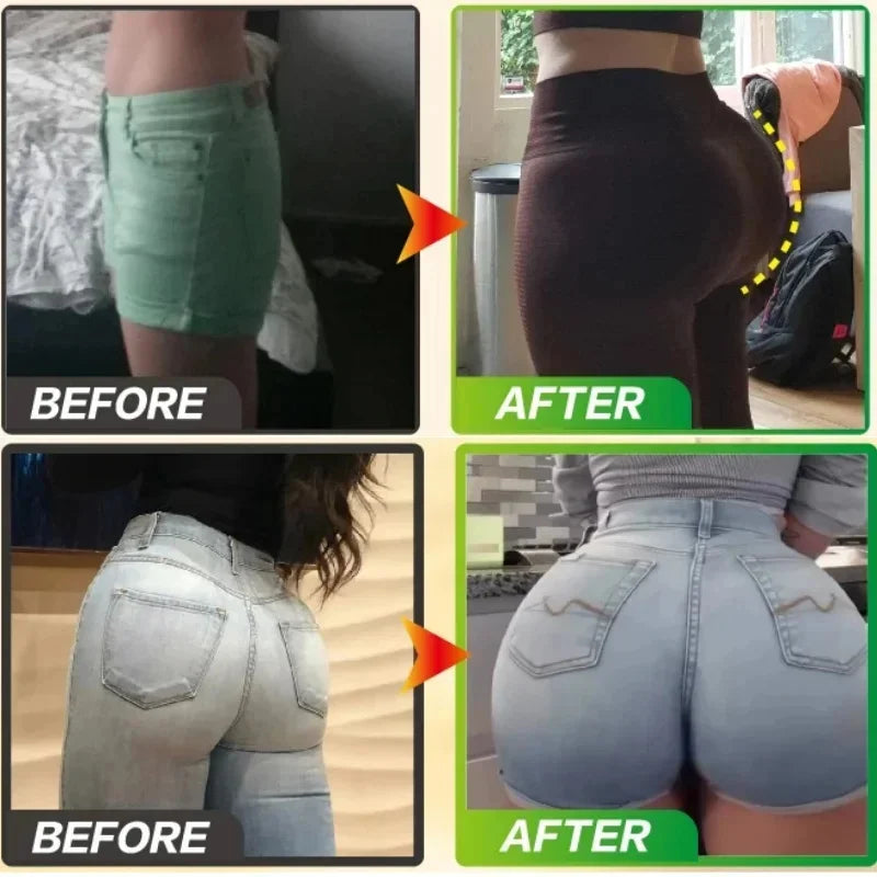 Butt Enhancement Essential Oil for Firming and Lifting - Smarsty