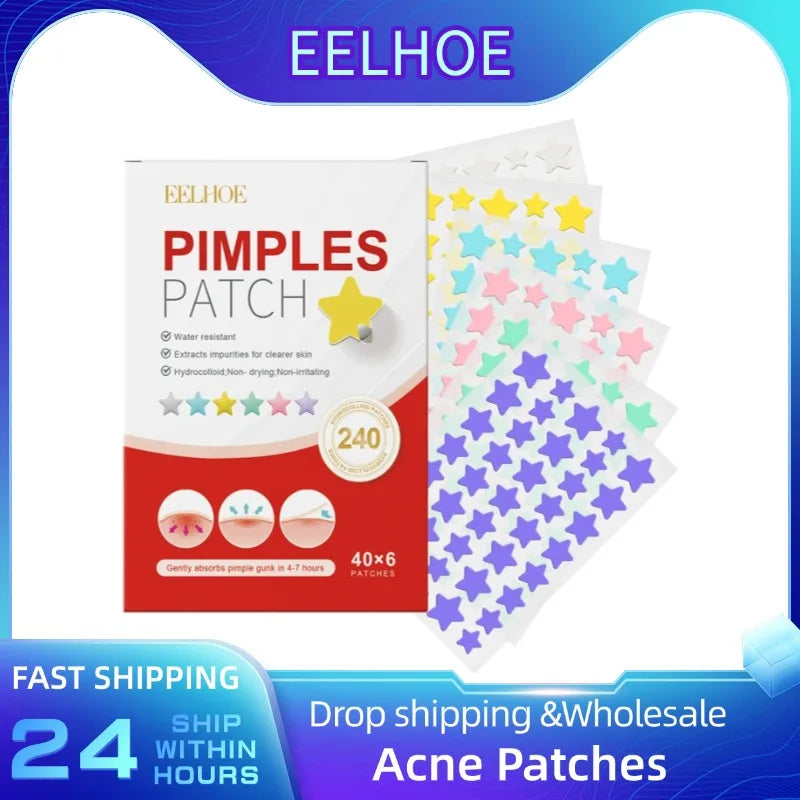 240pcs Star Acne Patches For Effective Spot Treatment - Smarsty