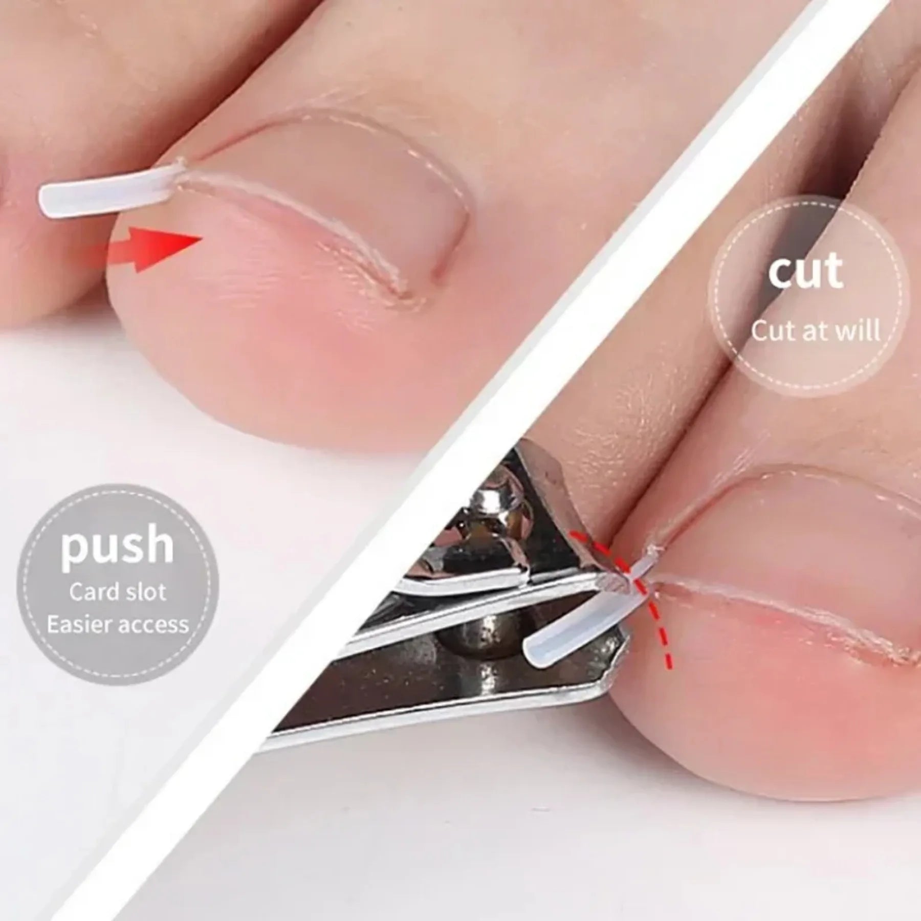 Ingrown Toenail Correction Tool Set for Effective Treatment - Smarsty