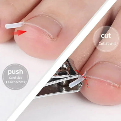Ingrown Toenail Correction Tool Set for Effective Treatment - Smarsty