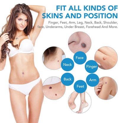 2 in 1 Skin Tag Remover Kit for Effective Face Care - Smarsty