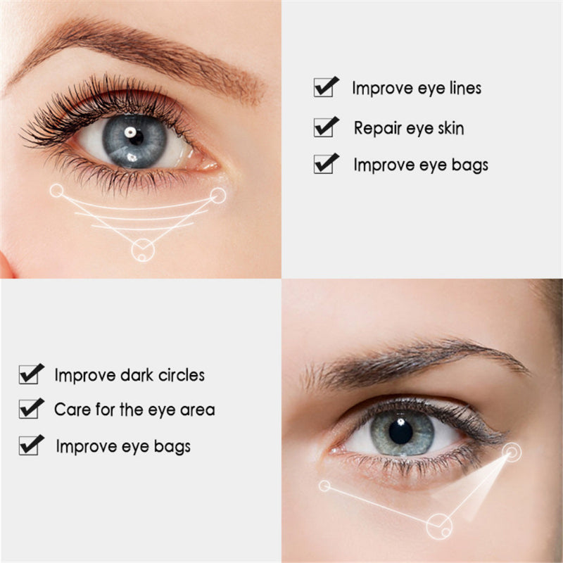 Nicotinamide Eye Cream for Dark Circles and Puffiness - Smarsty