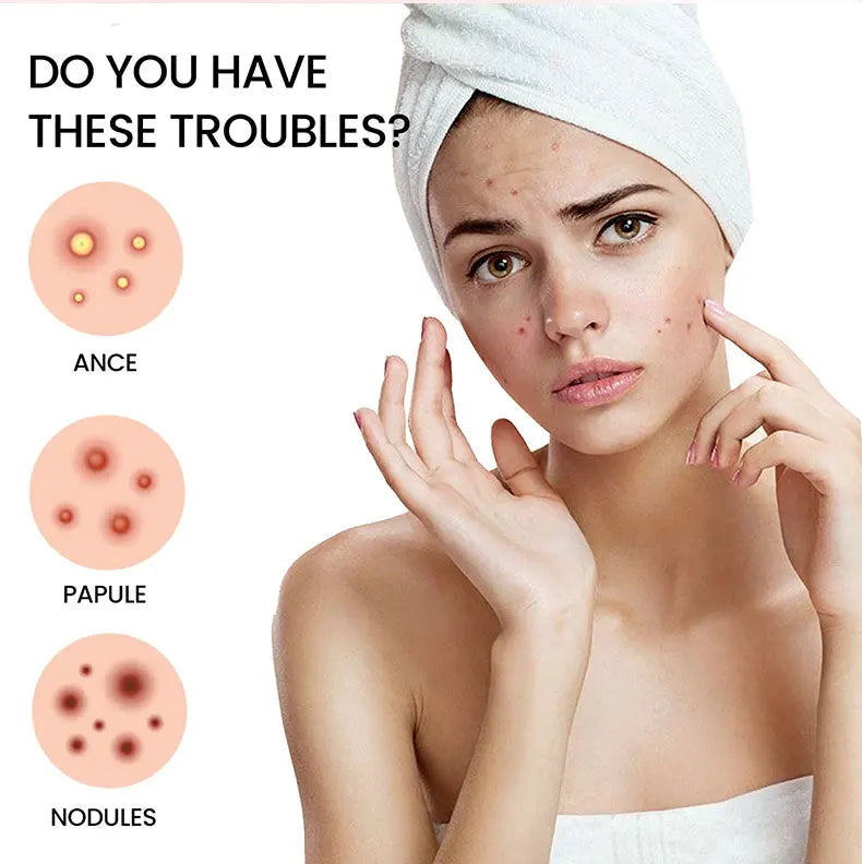 Effective Acne Repair Patch for Fading Blemishes - Smarsty