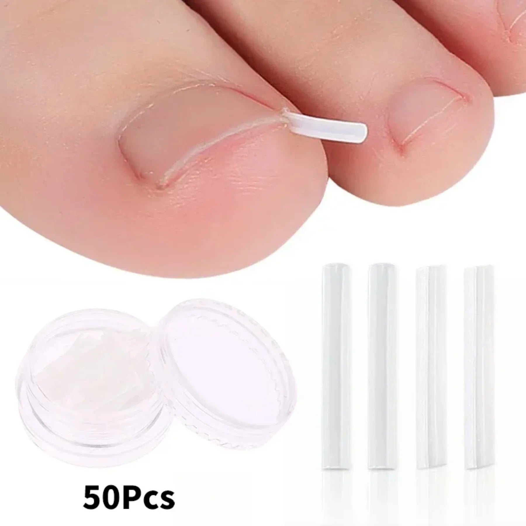 Ingrown Toenail Correction Tool Set for Effective Treatment - Smarsty