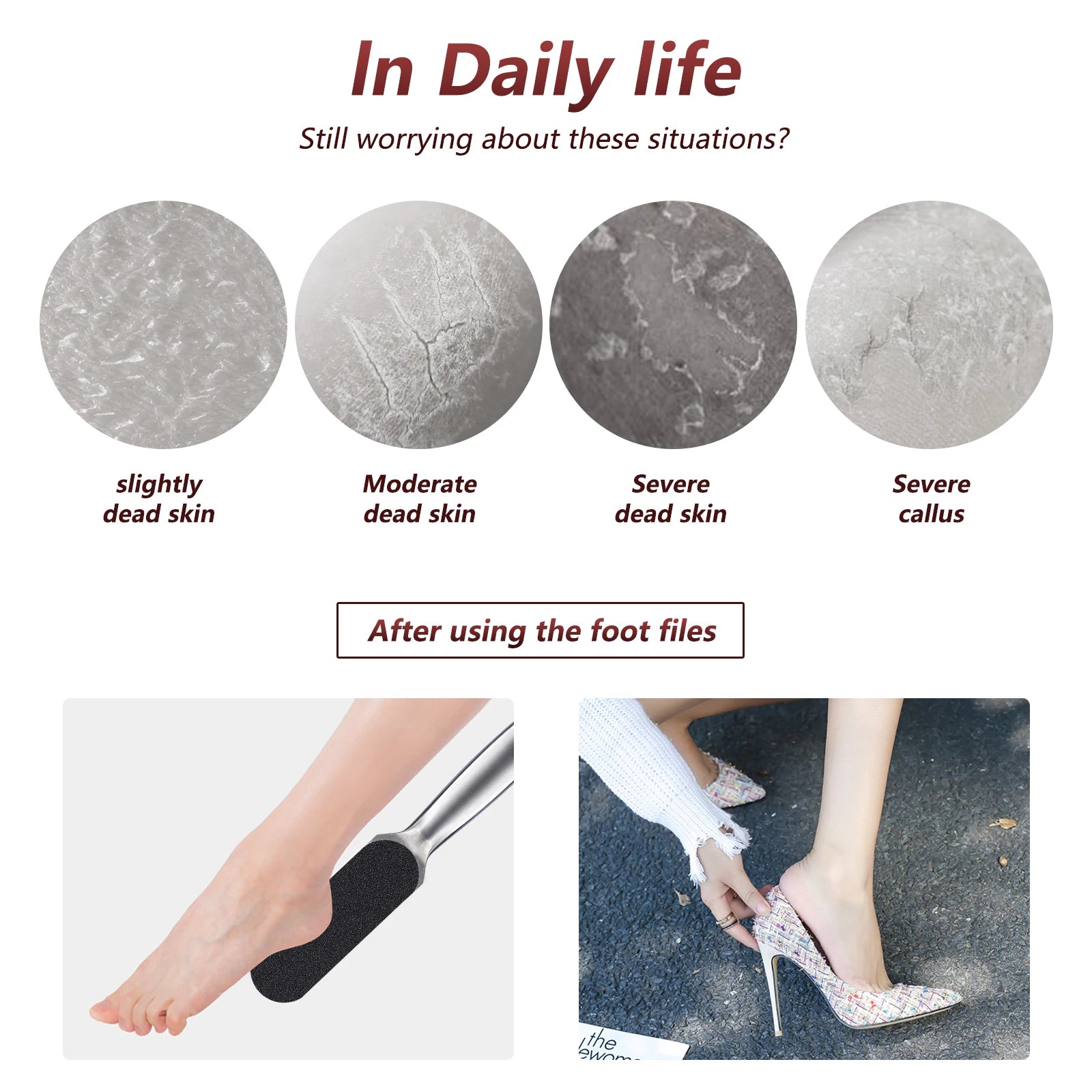Professional Foot Rasp Replacement Files for Effective Dead Skin Removal - Smarsty