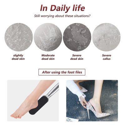 Professional Foot Rasp Replacement Files for Effective Dead Skin Removal - Smarsty