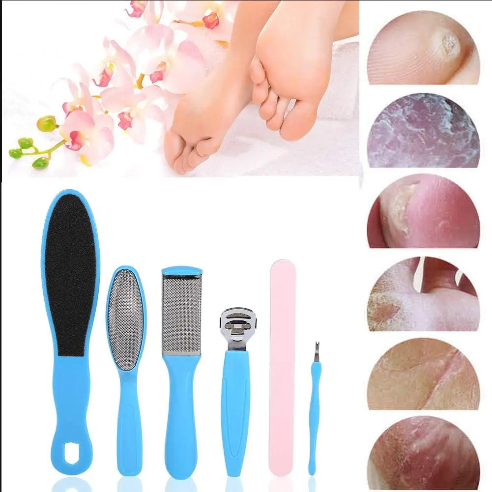 8 Piece Foot Exfoliating Rasp Set for Smooth Heels - Smarsty