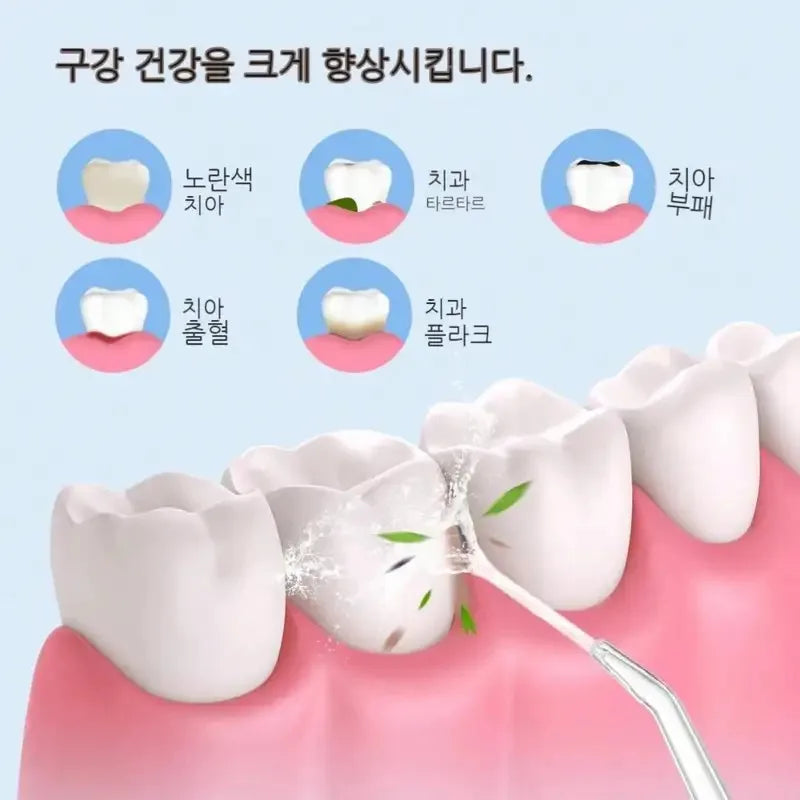 Electric Water Floss, Intelligent Chip, Precise Pressure Control, 360 Degree Rotating Nozzle, Tooth Cleaning Device - Smarsty