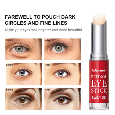 Retinol Eye Cream Stick for Dark Circles and Firming - Smarsty