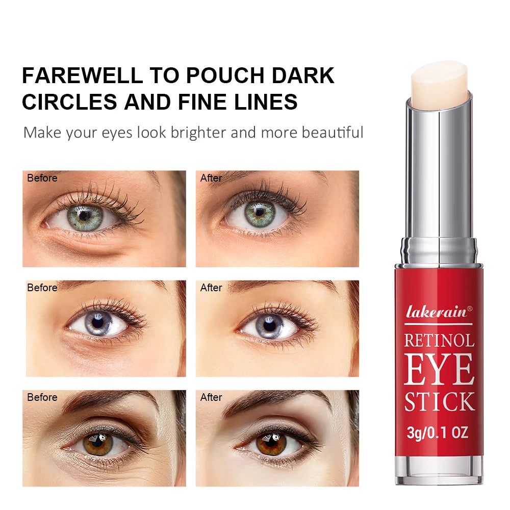 Retinol Eye Cream for Dark Circles and Firming - Smarsty