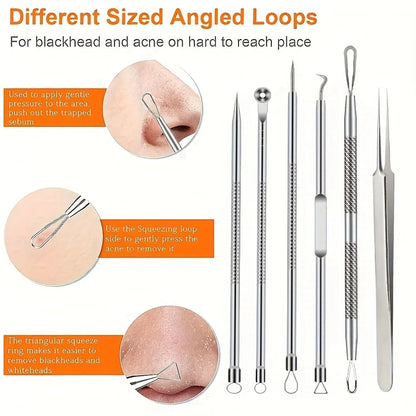 6 Piece Pimple Popper Tool Kit for Effective Acne Removal - Smarsty