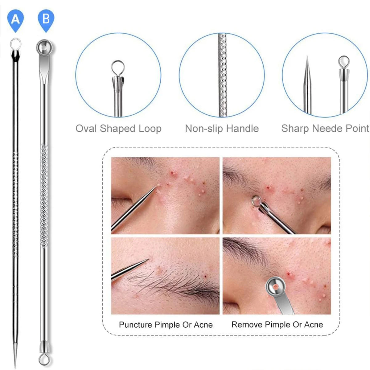 4PCS Acne Remover Tool Set for Clear Skin - Smarsty