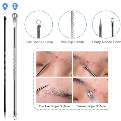 4PCS Acne Remover Tool Set for Clear Skin - Smarsty