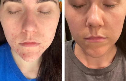 Beef Tallow Face Cream for Lasting Moisturization - Smarsty