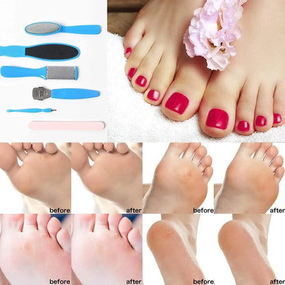 8 Piece Foot Exfoliating Rasp Set for Smooth Heels - Smarsty