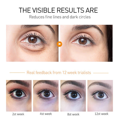 O'CHEAL Eye Moisturizing Cream for Dark Circles and Puffiness - Smarsty