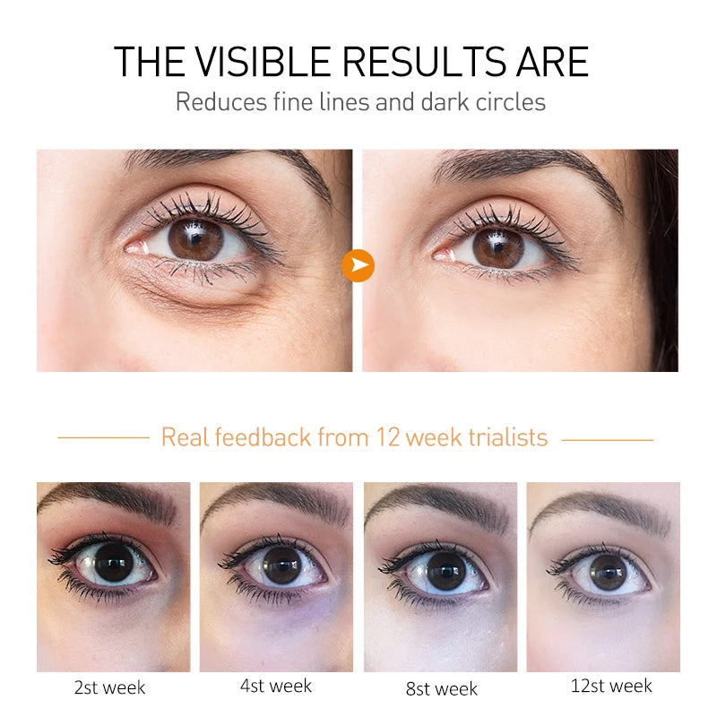 O'CHEAL Eye Moisturizing Cream for Dark Circles and Puffiness - Smarsty