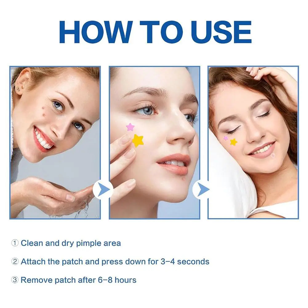 Colorful Star Acne Patches for Spot Treatment - Smarsty
