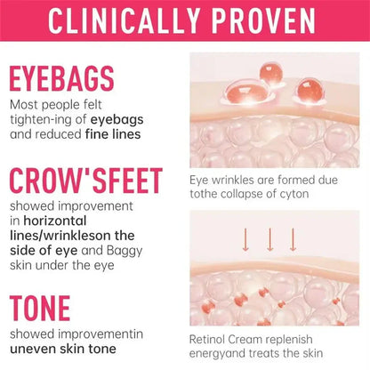 Instant Eye Bag Removal Cream for Dark Circles - Smarsty