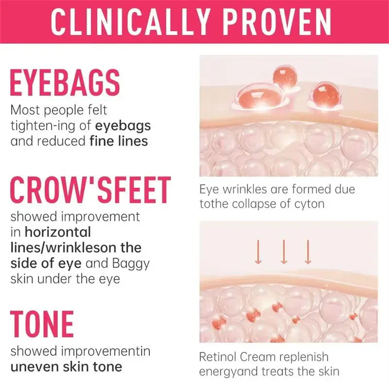 Instant Eye Bag Removal Cream for Dark Circles - Smarsty