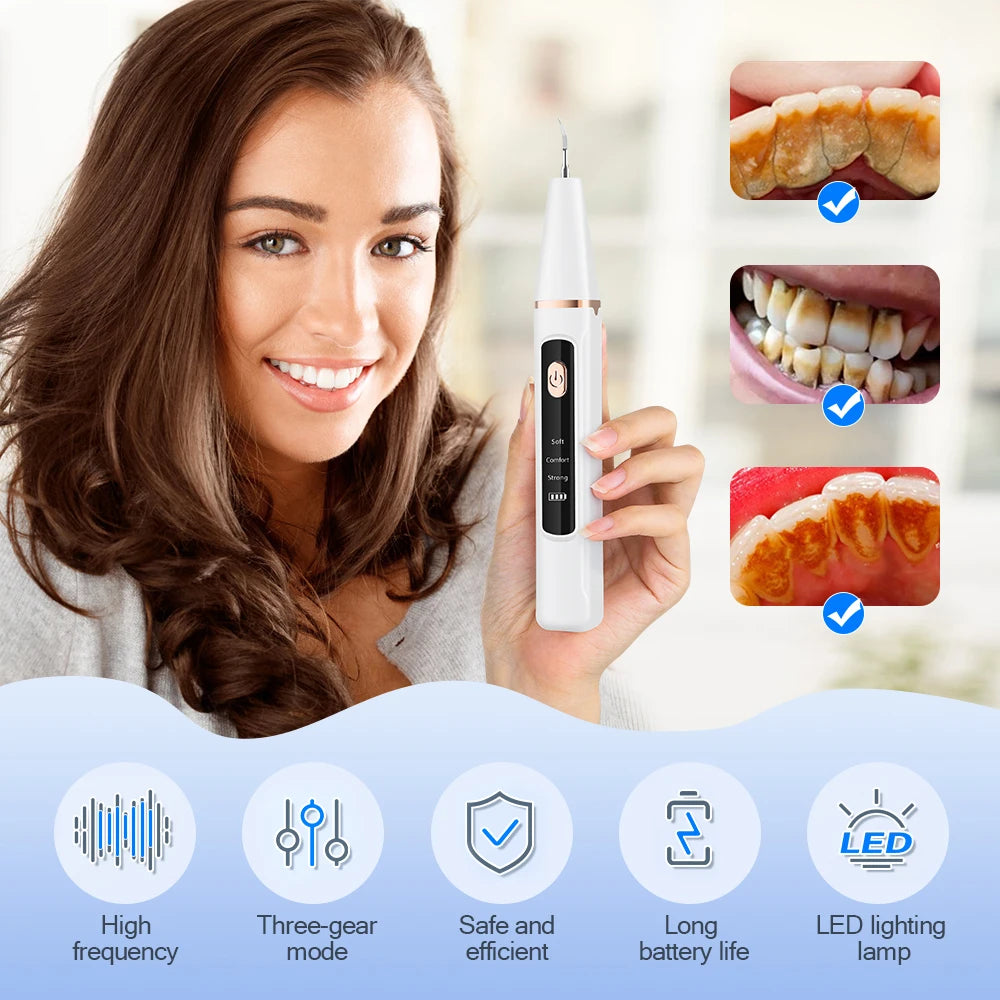 Ultrasonic Teeth Cleaner Tartar Remover Dental Calculus Stain Eraser Gum Multi Gear Type-C Rechargeable Portable Oral Care Tool - Smarsty