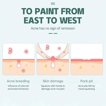 Colorful Star Heart Shaped Acne Pimple Patches - Smarsty