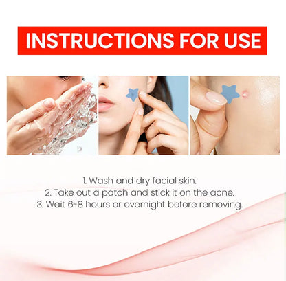 Effective Acne Repair Patch for Fading Blemishes - Smarsty