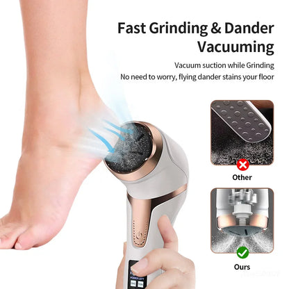 Rechargeable Electric Foot File Callus Remover for Smooth Feet - Smarsty