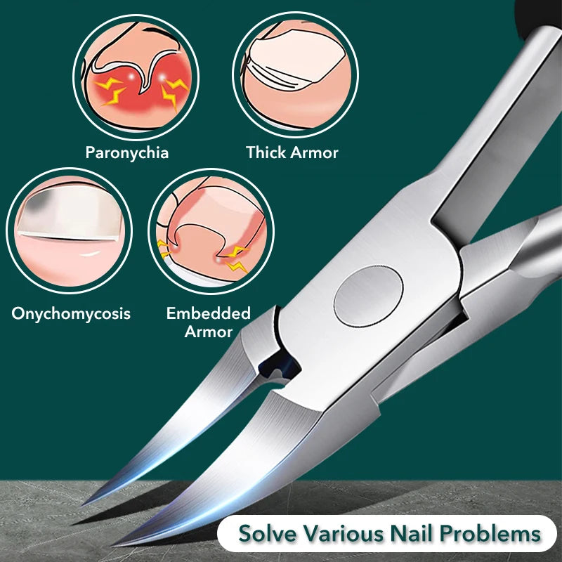 Stainless Steel Toe Nail Clippers for Ingrown Nails - Smarsty